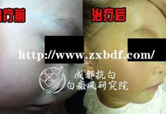 ��Ůͯ�沿���������ư����������ͯ��ʷ������