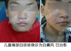 �ɶ��װ�,�ɶ��װ�ҽԺ,��ͯ��ǰװ߰װ�ԭ����ʲô(ͼ)